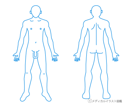 人体全身図白紙シェーマカルテ 両面 男性 メディカルイラスト図鑑 無料の医療 美容素材集