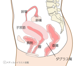 子宮横からの断面図 名称付き メディカルイラスト図鑑 無料の医療 美容素材集