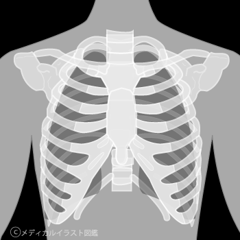 胸部ｘ線 レントゲン グレーバージョン メディカルイラスト図鑑 無料の医療 美容素材集
