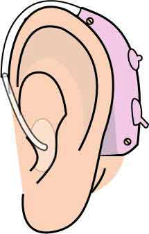 補聴器 装着図 メディカルイラスト図鑑 無料の医療 美容素材集